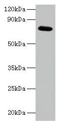 Western blot All lanes: ARPC3 antibody at 2µg/ml + 293T whole cell lysate Secondary Goat polyclonal to rabbit IgG at 1/15000 dilution Predicted band size: 21 kDa Observed band size: 75 kDa