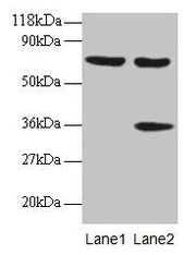 Western blot All lanes: SYNCRIP antibody at 2µg/ml Lane 1: EC109 whole cell lysate Lane 2: 293T whole cell lysate Secondary Goat polyclonal to rabbit IgG at 1/15000 dilution Predicted band size: 70, 66, 63, 59, 47 kDa Observed band size: 70, 36 kDa