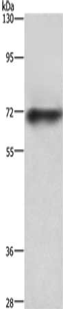 Gel: 6%SDS-PAGE,Lysate: 40 ug,,Primary antibody: CSB-PA033367(ABCB8 Antibody) at dilution 1/750 dilution,Secondary antibody: Goat anti rabbit IgG at 1/8000 dilution,Exposure time: 40 seconds
