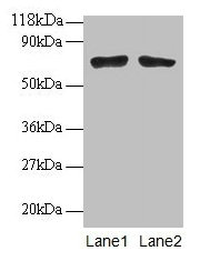 Western blot All lanes: BMI1 antibodyt 2µg/ml Lane 1: EC109 whole cell lysate Lane 2: 293T whole cell lysate Secondary Goat polyclonal to rabbit IgG at 1/15000 dilution Predicted band size: 37 kDa Observed band size: 70 kDa