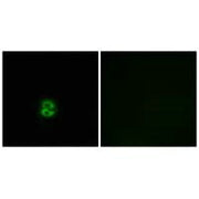 Immunofluorescence analysis of A549 cells, using CHST6 antibody.