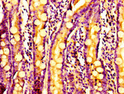 Immunohistochemistry of paraffin-embedded human small intestine tissue using CSB-PA03365A0Rb at dilution of 1:100
