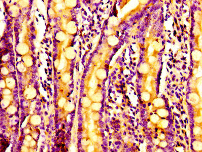 Immunohistochemistry of paraffin-embedded human small intestine tissue using CSB-PA03365A0Rb at dilution of 1:100