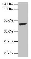 Western blot All lanes: STARD7 antibody at 2µg/ml + PC-3 whole cell lysate Secondary Goat polyclonal to rabbit IgG at 1/10000 dilution Predicted band size: 44 kDa Observed band size: 44 kDa