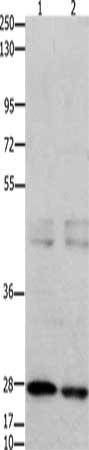 Gel: 10%SDS-PAGE, Lysate: 40 ug, Lane 1-2: 231 cells, mouse testis tissue, Primary antibody: CSB-PA033761(GNRHR Antibody) at dilution 1/650, Secondary antibody: Goat anti rabbit IgG at 1/8000 dilution, Exposure time: 7 seconds