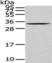 Gel: 12%SDS-PAGE, Lysate: 40 ug, Lane: K562 cell, Primary antibody: CSB-PA034107(HNRNPC Antibody) at dilution 1/200 dilution, Secondary antibody: Goat anti rabbit IgG at 1/8000 dilution, Exposure time: 1 minute