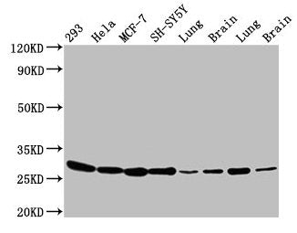 Western Blot Positive WB detected in: 293 whole cell lysate, Hela whole cell lysate, MCF-7 whole cell lysate, SH-SY5Y whole cell lysate, Rat lung tissue, Rat brain tissue, Mouse lung tissue, Mouse brain tissue All lanes: BCAP31 antibody at 4.8µg/m...
