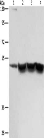 Gel: 8%SDS-PAGE, Lysate: 40 ug, Lane 1-4: Hela cells, mouse brain tissue, Jurkat cells, Raw264.7 cells, Primary antibody: CSB-PA034401(ING1 Antibody) at dilution 1/267, Secondary antibody: Goat anti rabbit IgG at 1/8000 dilution, Exposure time: 1...