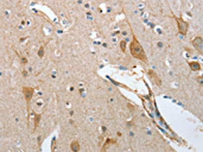 The image on the left is immunohistochemistry of paraffin-embedded Human brain tissue using CSB-PA034483(NOL3 Antibody) at dilution 1/35, on the right is treated with fusion protein. (Original magnification: ×200)