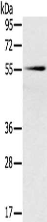 Gel: 8%SDS-PAGE, Lysate: 40 ug, Lane: Mouse pancreas tissue, Primary antibody: CSB-PA034553(SLC16A10 Antibody) at dilution 1/200, Secondary antibody: Goat anti rabbit IgG at 1/8000 dilution, Exposure time: 2 minutes