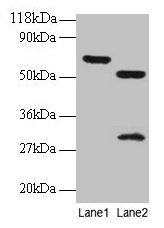 Western blot All lanes: ZNF384 antibody at 2µg/ml Lane 1: EC109 whole cell lysate Lane 2: 293T whole cell lysate Secondary Goat polyclonal to rabbit IgG at 1/15000 dilution Predicted band size: 64, 57, 51 kDa Observed band size: 64, 51, 30 kDa