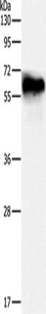 Gel: 8%SDS-PAGE, Lysate: 30 ug, Lane: Human fetal brain tissue, Primary antibody: CSB-PA034607(DPYSL4 Antibody) at dilution 1/500, Secondary antibody: Goat anti rabbit IgG at 1/8000 dilution, Exposure time: 10 seconds