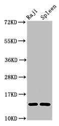 Western Blot Positive WB detected in: Raji whole cell lysate, Rat spleen tissue All lanes: GABARAPL2 antibody at 4µg/ml Secondary Goat polyclonal to rabbit IgG at 1/50000 dilution Predicted band size: 14 kDa Observed band size: 14 kDa