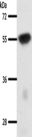 Gel: 10%SDS-PAGE, Lysate: 40 ug, Lane: Mouse brain tissue, Primary antibody: CSB-PA034916(SLC32A1 Antibody) at dilution 1/950, Secondary antibody: Goat anti rabbit IgG at 1/8000 dilution, Exposure time: 20 seconds