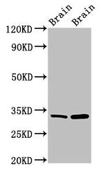 Western Blot Positive WB detected in: Mouse brain tissue, Rat brain tissue All lanes: HAX1 antibody at 1.5µg/ml Secondary Goat polyclonal to rabbit IgG at 1/50000 dilution Predicted band size: 32, 33, 29, 15, 27, 22 kDa Observed band size: 32 kDa
