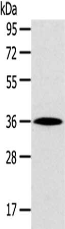Gel: 8%SDS-PAGE,Lysate: 40 ug,,Primary antibody: CSB-PA035233(HOXD13 Antibody) at dilution 1/200 dilution,Secondary antibody: Goat anti rabbit IgG at 1/8000 dilution,Exposure time: 30 seconds