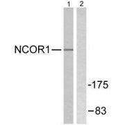 Western blot analysis of extracts from MDA-MB-435 cells, using NCoR1 antibody.