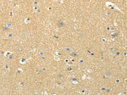 The image on the left is immunohistochemistry of paraffin-embedded Human brain tissue using CSB-PA035388(MSI1 Antibody) at dilution 1/30, on the right is treated with synthetic peptide. (Original magnification: ×200)
