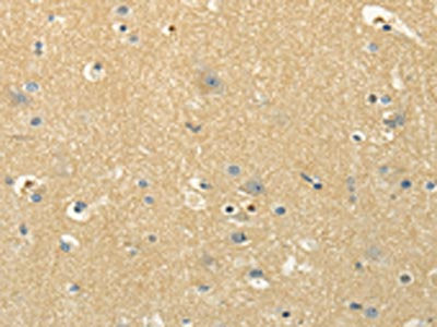 The image on the left is immunohistochemistry of paraffin-embedded Human brain tissue using CSB-PA035388(MSI1 Antibody) at dilution 1/30, on the right is treated with synthetic peptide. (Original magnification: ×200)