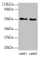 Western blot All lanes: VOPP1 antibody at 2µg/ml Lane 1: EC109 whole cell lysate Lane 2: 293T whole cell lysate Secondary Goat polyclonal to rabbit IgG at 1/15000 dilution Predicted band size: 20, 19, 18 kDa Observed band size: 50 kDa