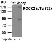 Western blot analysis of extracts from Rat kindey using ROCK2 (Phospho-Tyr722) antibody.The lane on the left is treated with the antigen-specific peptide.