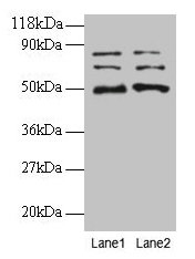 Western blot All lanes: VOPP1 antibody at 2µg/ml Lane 1: EC109 whole cell lysate Lane 2: 293T whole cell lysate Secondary Goat polyclonal to rabbit IgG at 1/15000 dilution Predicted band size: 20, 19, 18 kDa Observed band size: 50, 70, 80 kDa