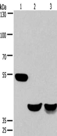 Gel: 6%SDS-PAGE, Lysate: 40 ug, Lane 1-3: Mouse brain tissue, human fetal muscle tissue, mouse heart tissue, Primary antibody: CSB-PA035641(CABLES1 Antibody) at dilution 1/650, Secondary antibody: Goat anti rabbit IgG at 1/8000 dilution, Exposure...