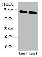 Western blot All lanes: OTUB1 antibody at 2µg/ml Lane 1: EC109 whole cell lysate Lane 2: 293T whole cell lysate Secondary Goat polyclonal to rabbit IgG at 1/15000 dilution Predicted band size: 32, 36 kDa Observed band size: 80 kDa