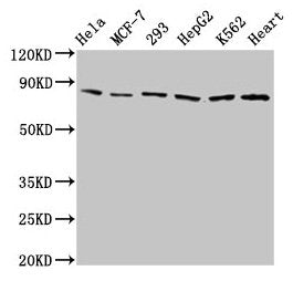 Western Blot Positive WB detected in: Hela whole cell lysate, MCF-7 whole cell lysate, 293 whole cell lysate, HepG2 whole cell lysate, K562 whole cell lysate, Mouse heart tissue All lanes: TRAP1 antibody at 2µg/ml Secondary Goat polyclonal to rabb...