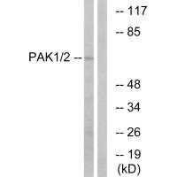 Western blot analysis of extracts from K562 cells, using PAK1/2 (Ab-199) antibody.