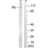 Western blot analysis of extracts from Jurkat cells, treated with PMA (125ng/ml, 30mins), using Retinoblastoma (Ab-608) antibody.