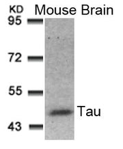 Western blot analysis of extracts from Mouse Brain tissue using Tau(Ab-181) Antibody.