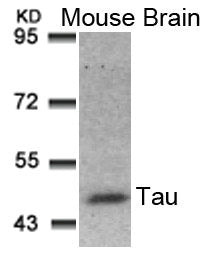 Western blot analysis of extracts from Mouse Brain tissue using Tau(Ab-181) Antibody.