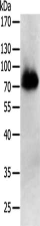 Gel: 10%SDS-PAGE, Lysate: 50 ug, Lane: Human liver cancer tissue, Primary antibody: CSB-PA036451(PRMT7 Antibody) at dilution 1/500, Secondary antibody: Goat anti rabbit IgG at 1/8000 dilution, Exposure time: 5 minutes