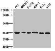 Western Blot Positive WB detected in: PC-3 whole cell lysate, HEK293 whole cell lysate, HepG2 whole cell lysate, MCF-7 whole cell lysate, Hela whole cell lysate, A375 whole cell lysate All lanes: COPE antibody at 3µg/ml Secondary Goat polyclonal t...