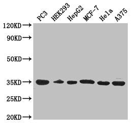Western Blot Positive WB detected in: PC-3 whole cell lysate, HEK293 whole cell lysate, HepG2 whole cell lysate, MCF-7 whole cell lysate, Hela whole cell lysate, A375 whole cell lysate All lanes: COPE antibody at 3µg/ml Secondary Goat polyclonal t...