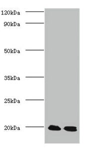 Western blot All lanes: Protein DJ-1 antibody at 2ug/ml Lane 1: EC109 whole cell lysate Lane 2: 293T whole cell lysate Secondary Goat polyclonal to Rabbit IgG at 1/15000 dilution Predicted band size: 20 kDa Observed band size: 20 kDa