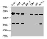 Western Blot Positive WB detected in: HepG2 whole cell lysate, 293T whole cell lysate, Hela whole cell lysate, MCF-7 whole cell lysate, K562 whole cell lysate, LO2 whole cell lysate, Jurkat whole cell lysate All lanes: UBC antibody at 1:2000 Secon...