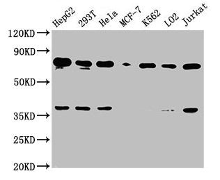 Western Blot Positive WB detected in: HepG2 whole cell lysate, 293T whole cell lysate, Hela whole cell lysate, MCF-7 whole cell lysate, K562 whole cell lysate, LO2 whole cell lysate, Jurkat whole cell lysate All lanes: UBC antibody at 1:2000 Secon...