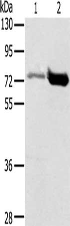 Gel: 8%SDS-PAGE, Lysate: 40 ug, Lane 1-2: Human testis tissue, human placenta tissue, Primary antibody: CSB-PA037444(PIAS1 Antibody) at dilution 1/200, Secondary antibody: Goat anti rabbit IgG at 1/8000 dilution, Exposure time: 5 seconds