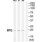 Western blot analysis of extracts from 293/Jurkat/HeLa cells, using BTC antibody.
