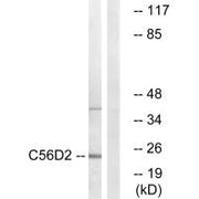 Western blot analysis of extracts from Jurkat cells, using C56D2 antibody.
