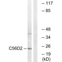 Western blot analysis of extracts from Jurkat cells, using C56D2 antibody.