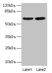Western Blot All lanes: NELFB antibody at 2µg/ml Lane 1: NIH/3T3 whole cell lysate Lane 2: HL60 whole cell lysate Secondary Goat polyclonal to rabbit IgG at 1/15000 dilution Predicted band size: 66 kDa Observed band size: 66 kDa