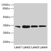 Western blot All lanes: RAD23A antibody at 3µg/ml Lane 1: MCF-7 whole cell lysate Lane 2: Hela whole cell lysate Lane 3: Raji whole cell lysate Lane 4: Jurkat whole cell lysate Secondary Goat polyclonal to rabbit IgG at 1/10000 dilution Predicted...