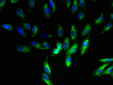 Immunofluorescent analysis of Hela cells using CSB-PA03785A0Rb at dilution of 1:100 and Alexa Fluor 488-congugated AffiniPure Goat Anti-Rabbit IgG(H+L)