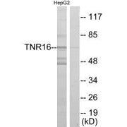 Western blot analysis of extracts from HepG2 cells, using TNR16 antibody.