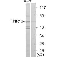 Western blot analysis of extracts from HepG2 cells, using TNR16 antibody.