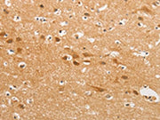 The image on the left is immunohistochemistry of paraffin-embedded Human brain tissue using CSB-PA038132(CDH6 Antibody) at dilution 1/50, on the right is treated with fusion protein. (Original magnification: ×200)