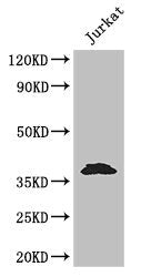 Western Blot Positive WB detected in: Jurkat whole cell lysate All lanes: MCL1 antibody at 3.2ug/ml Secondary Goat polyclonal to rabbit IgG at 1/50000 dilution Predicted band size: 38, 29 kDa Observed band size: 38 kDa